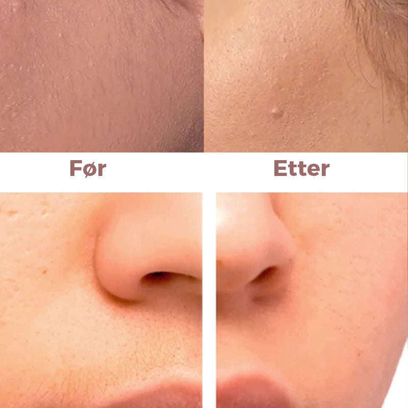 Facial Epilator - Instant and Painless Hair Removal