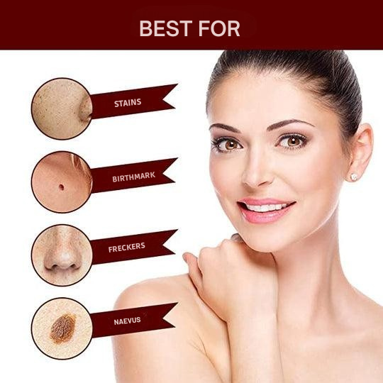 Wart Remover | Precision Applicator for Spot Treatment | Plant-Based Care Formula | WartOff