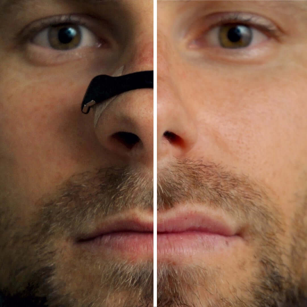 Airo Magnetic Nasal Strip Set - The New Standard for Breathing