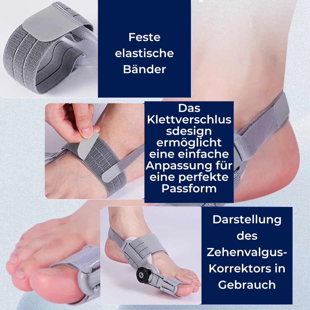 BunionEase Adjustable Relief Supports | Hallux Valgus Corrector