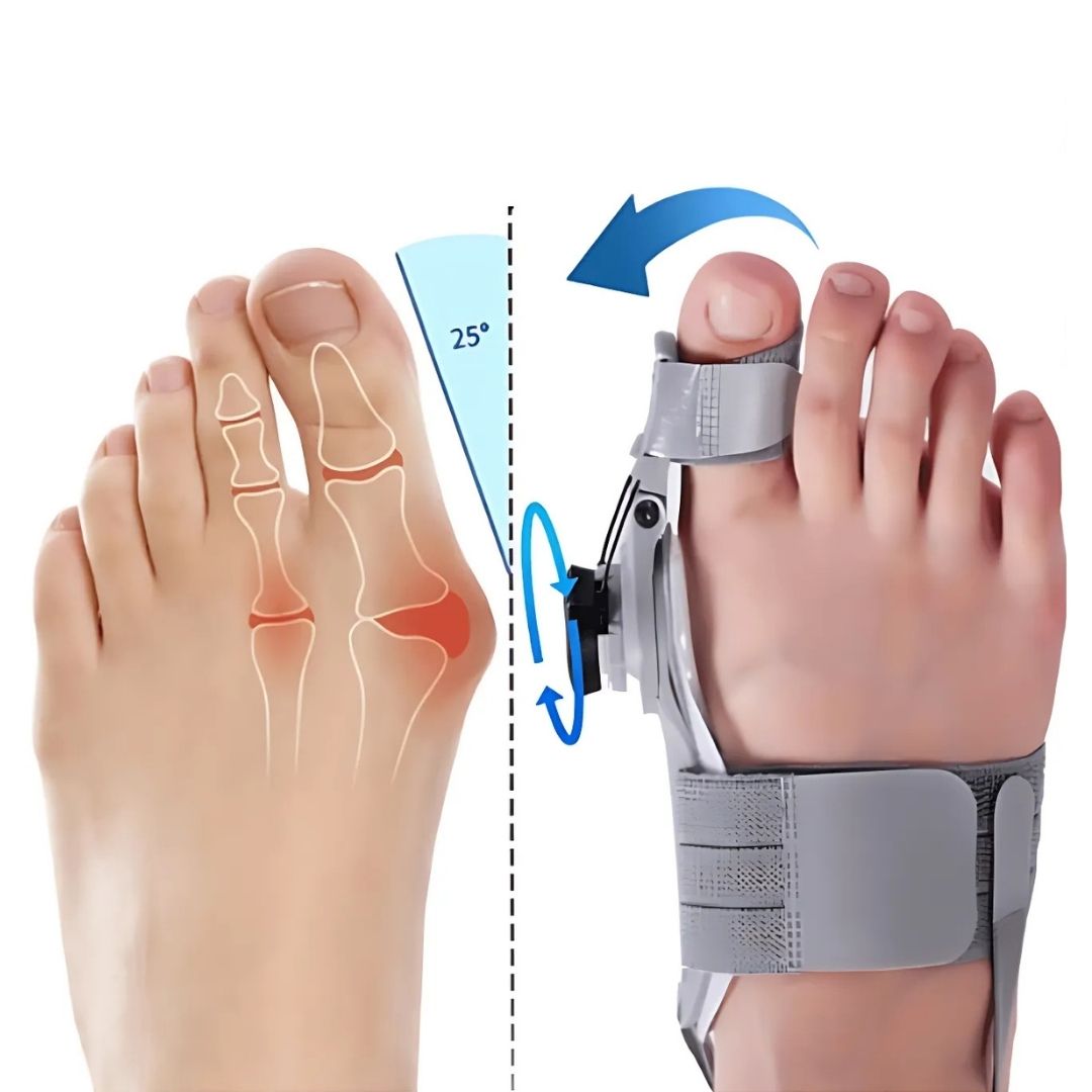 BunionEase Adjustable Relief Supports | Hallux Valgus Corrector