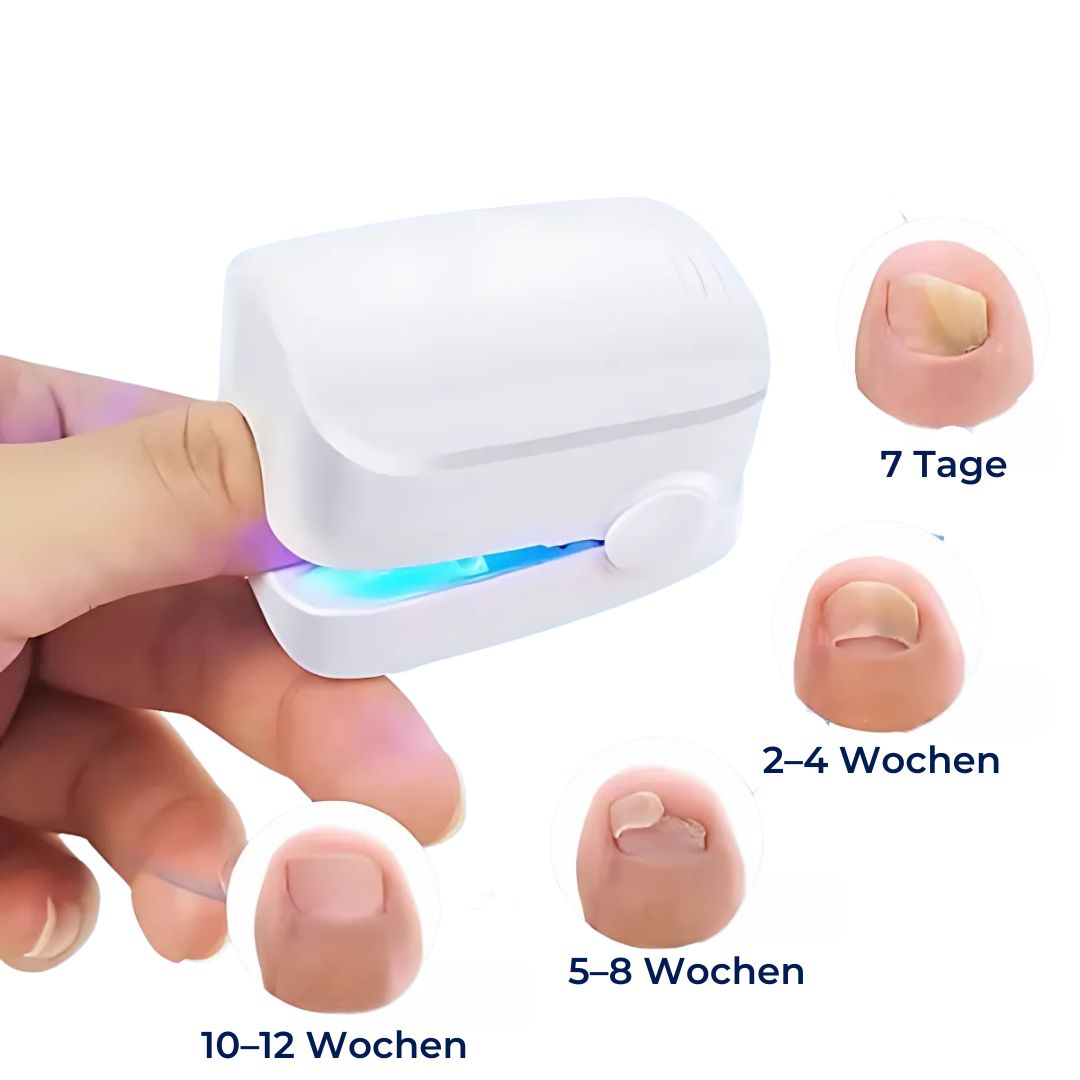 ClearNail Pro | Nail Fungus Laser Device - Painless - Effective