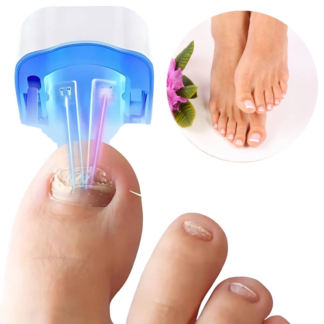 ClearNail Pro | Nail Fungus Laser Device - Painless - Effective