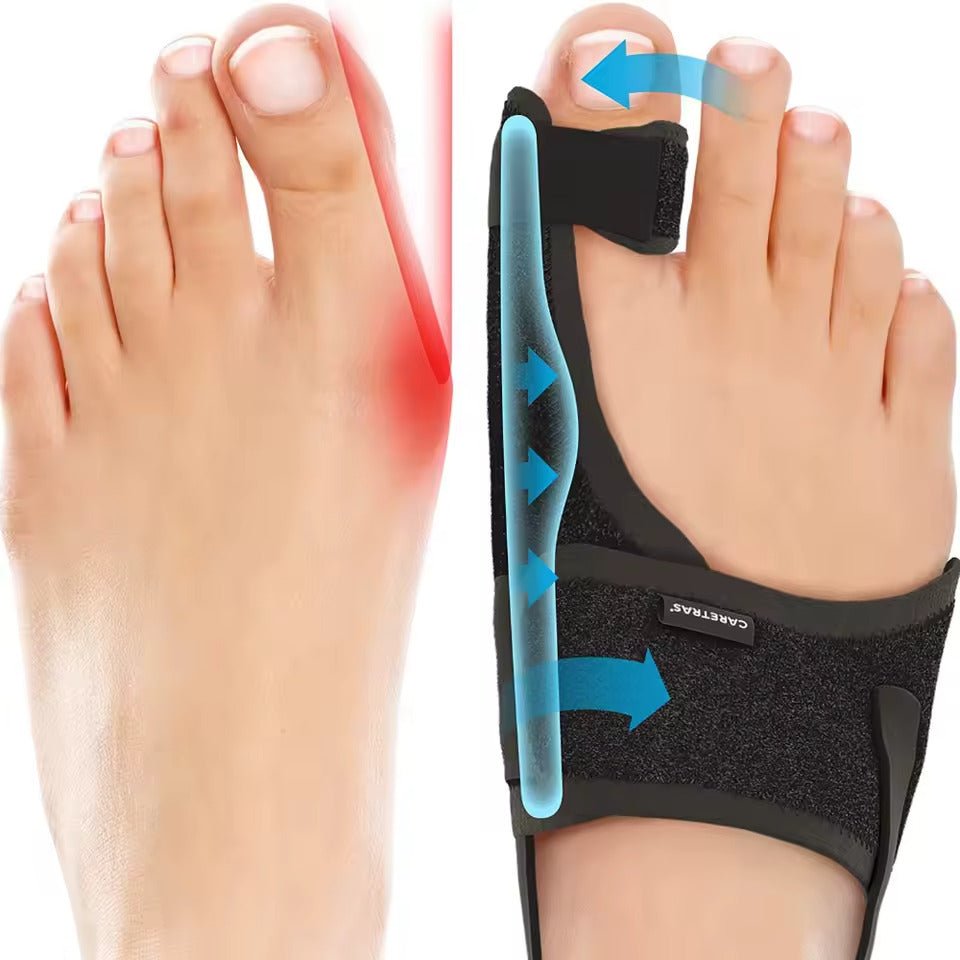 Closora | Night Splint Hallux Valgus - Ergonomic and Adjustable Comfort