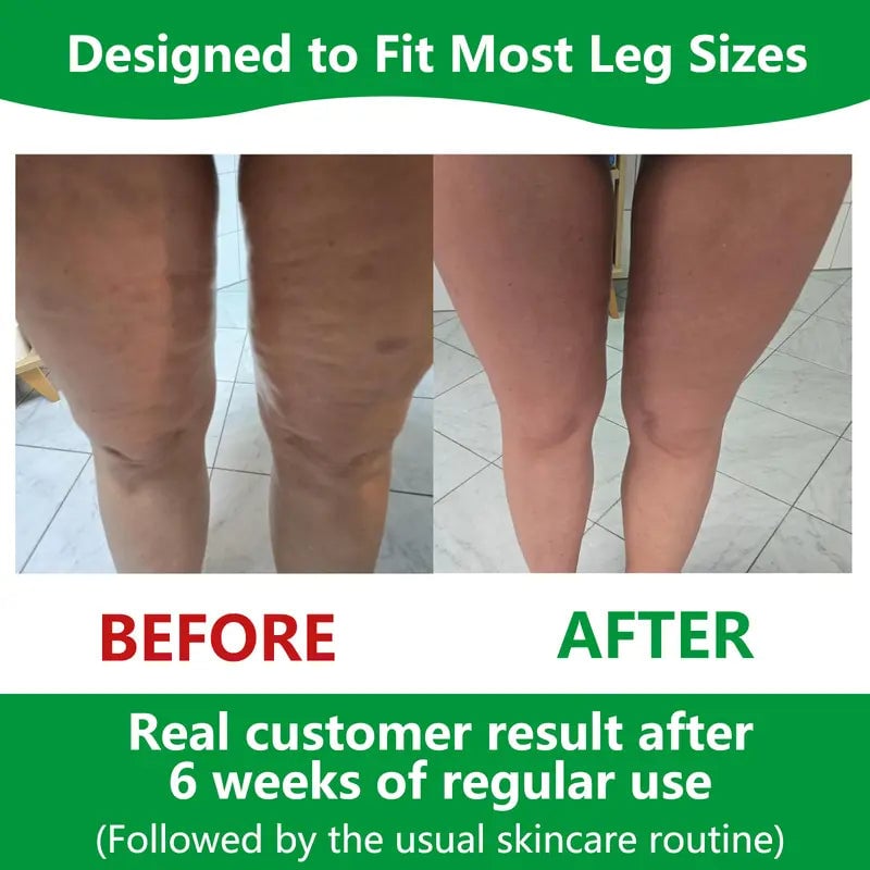 Closora | Sakerplus Cellulite Massage Roller