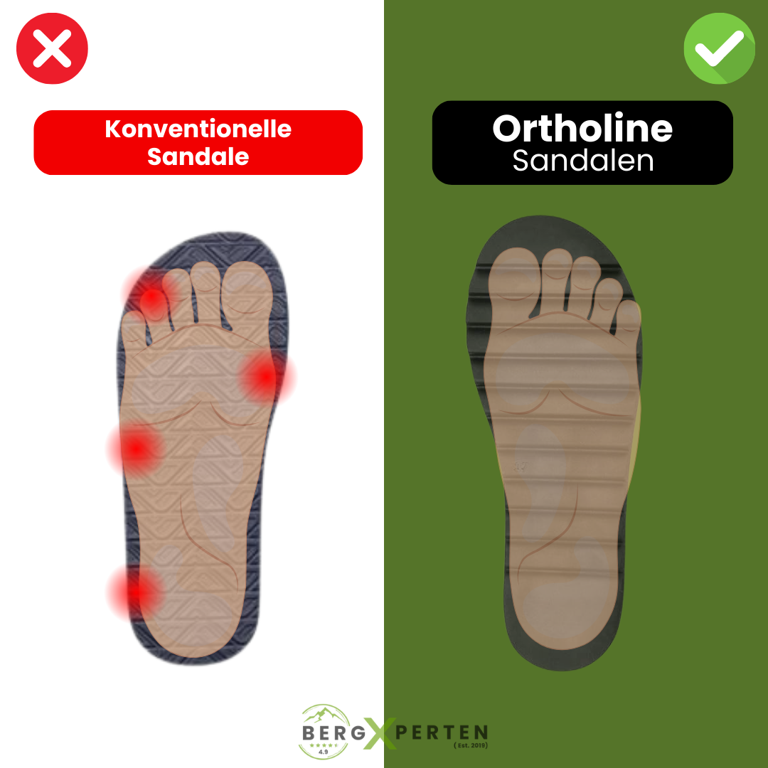 ComfortArch | Orthopaedic Sandals with Arch Support for Women