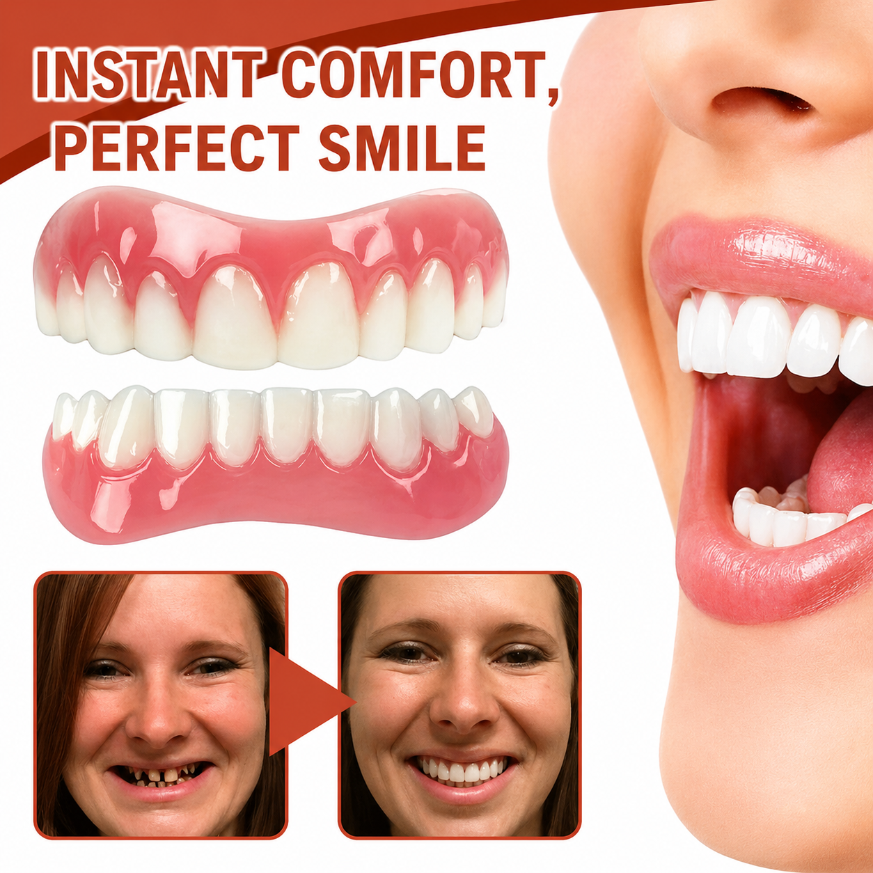 Dental Prosthesis | Soft Silicone Cushion | Non-Slip Fit Without Pressure Points | SecureSmile