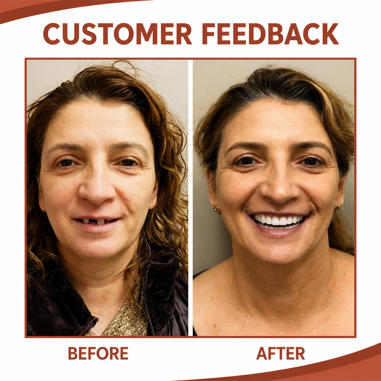 Dental Prosthesis | Soft Silicone Cushion | Non-Slip Fit Without Pressure Points | SecureSmile