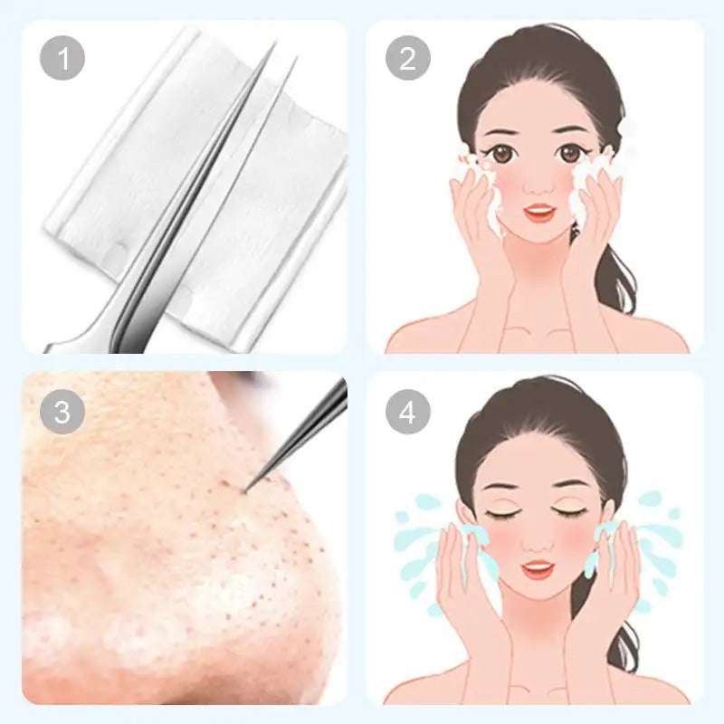 FacialTools - Stainless Steel Blackhead Remover Tool Set