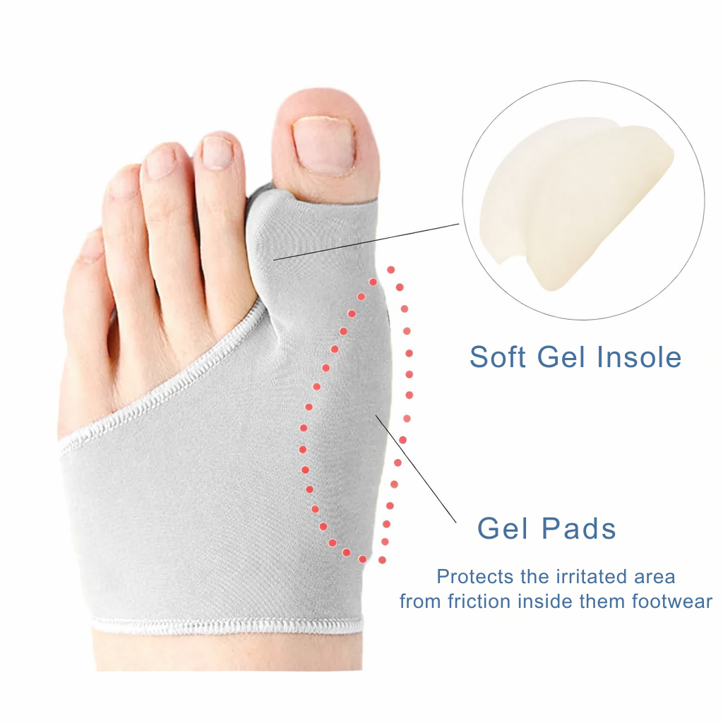 Hallux Valgus | Toe Corrector | Pressure Relief While Walking | ToeAlign