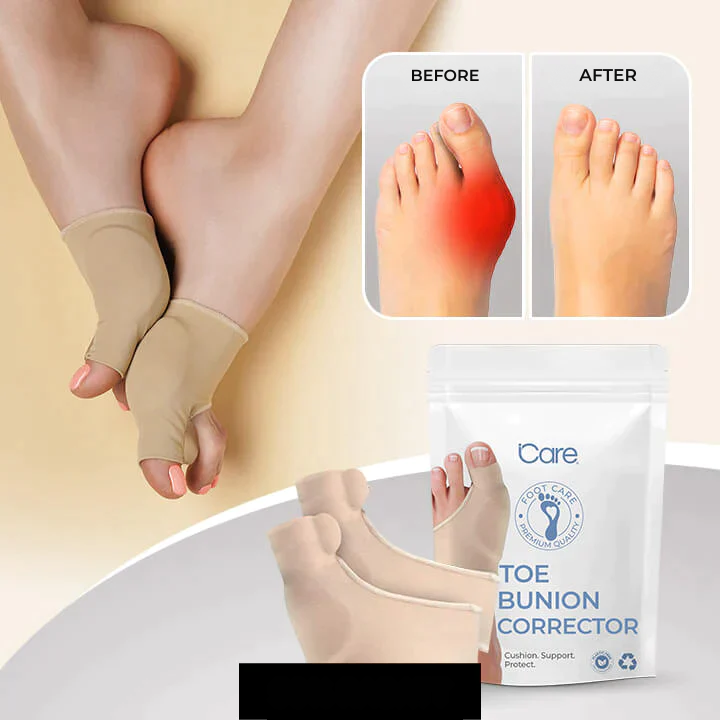Hallux Valgus | Toe Corrector | Pressure Relief While Walking | ToeAlign