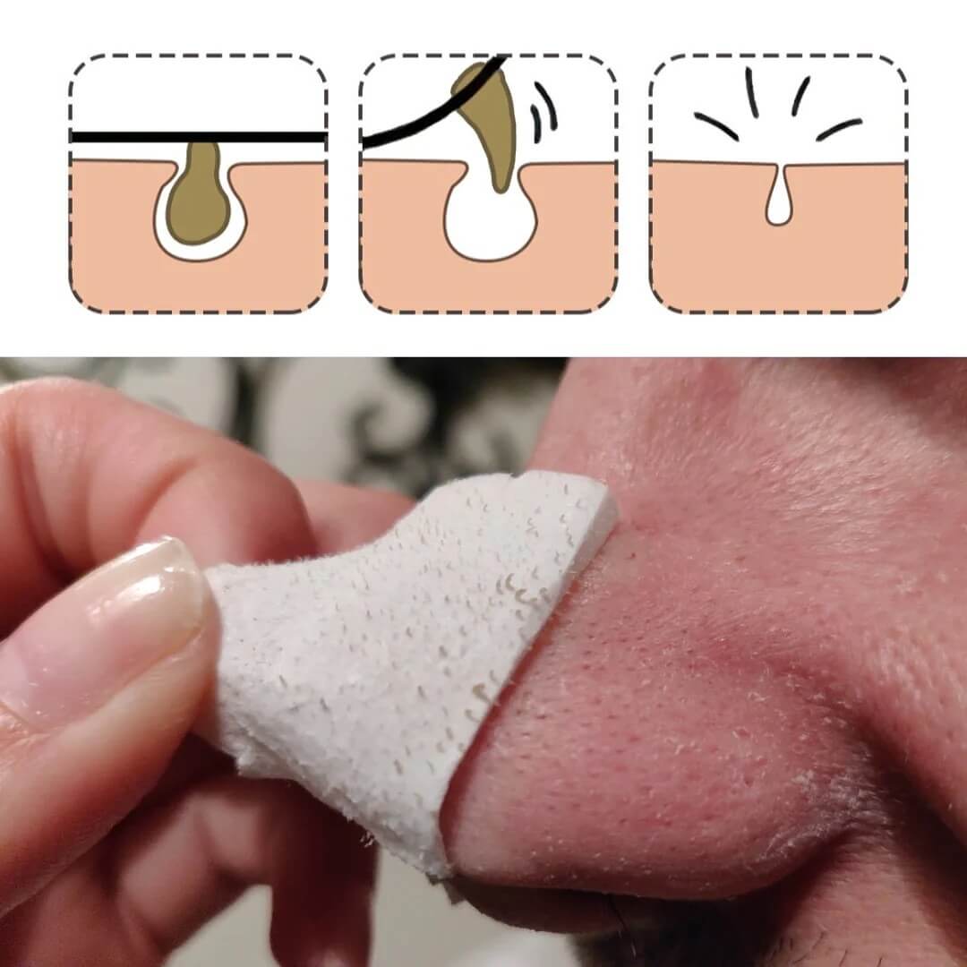 LANBENA Facial Mask for Blackheads