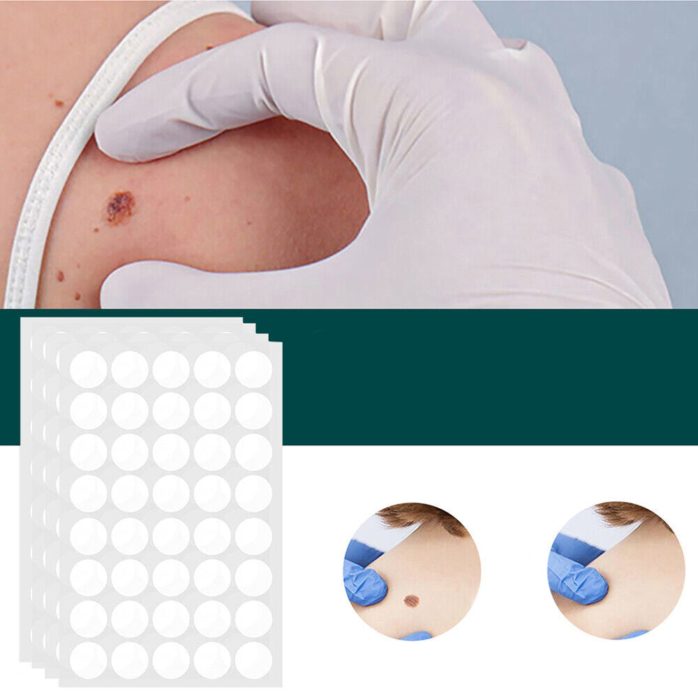 SkinClear - Patch for the removal of spots and warts Closora