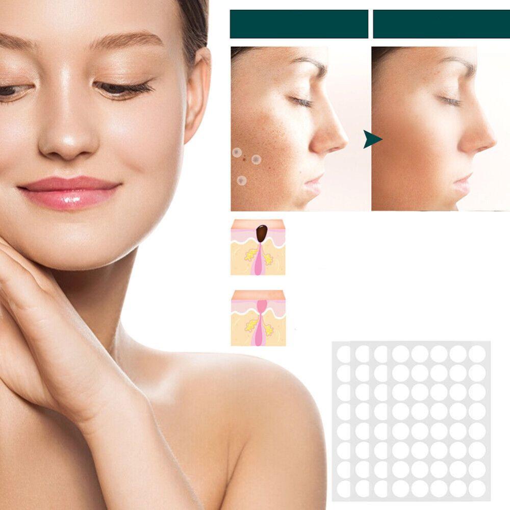 SkinClear - Patch for the removal of spots and warts Closora