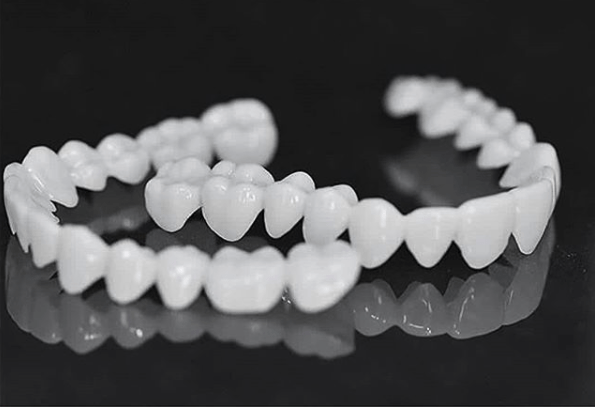 SmileFlex Dental Prosthesis with White Veneers