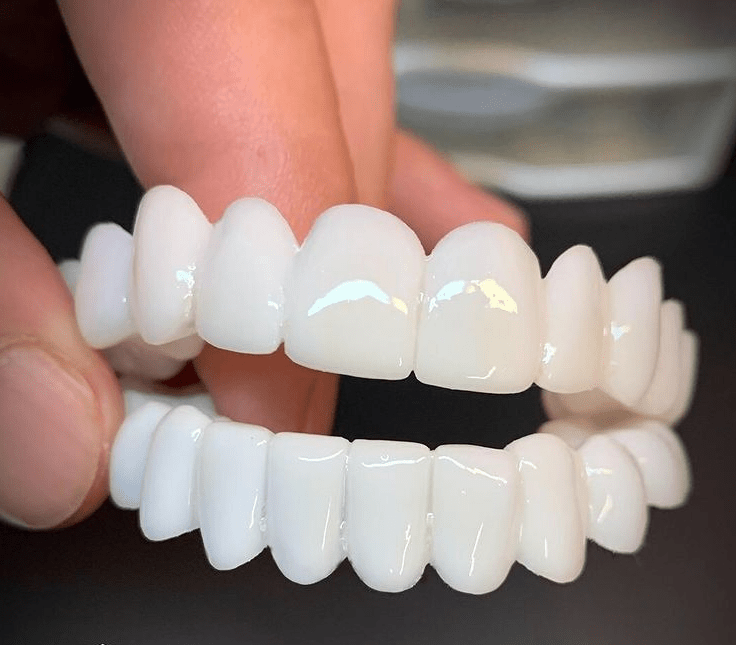SmileFlex Dental Prosthesis with White Veneers
