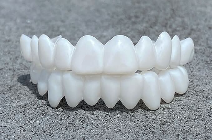 SmileFlex Dental Prosthesis with White Veneers