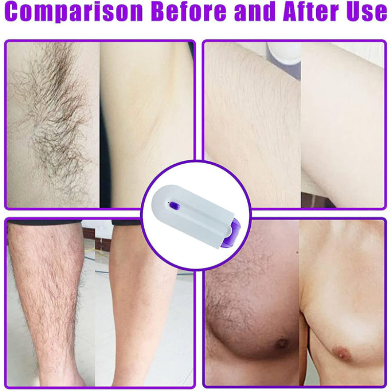 SmoothShaver - Multi-Purpose Smooth Gentle Painless Hair Removal Shaver