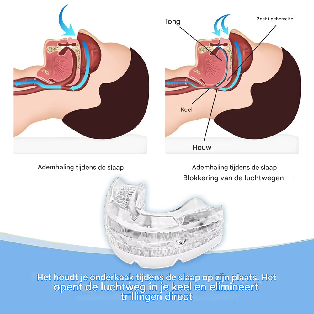 SomnoPro™ | The medical breakthrough that definitively stops sleep apnea and snoring
