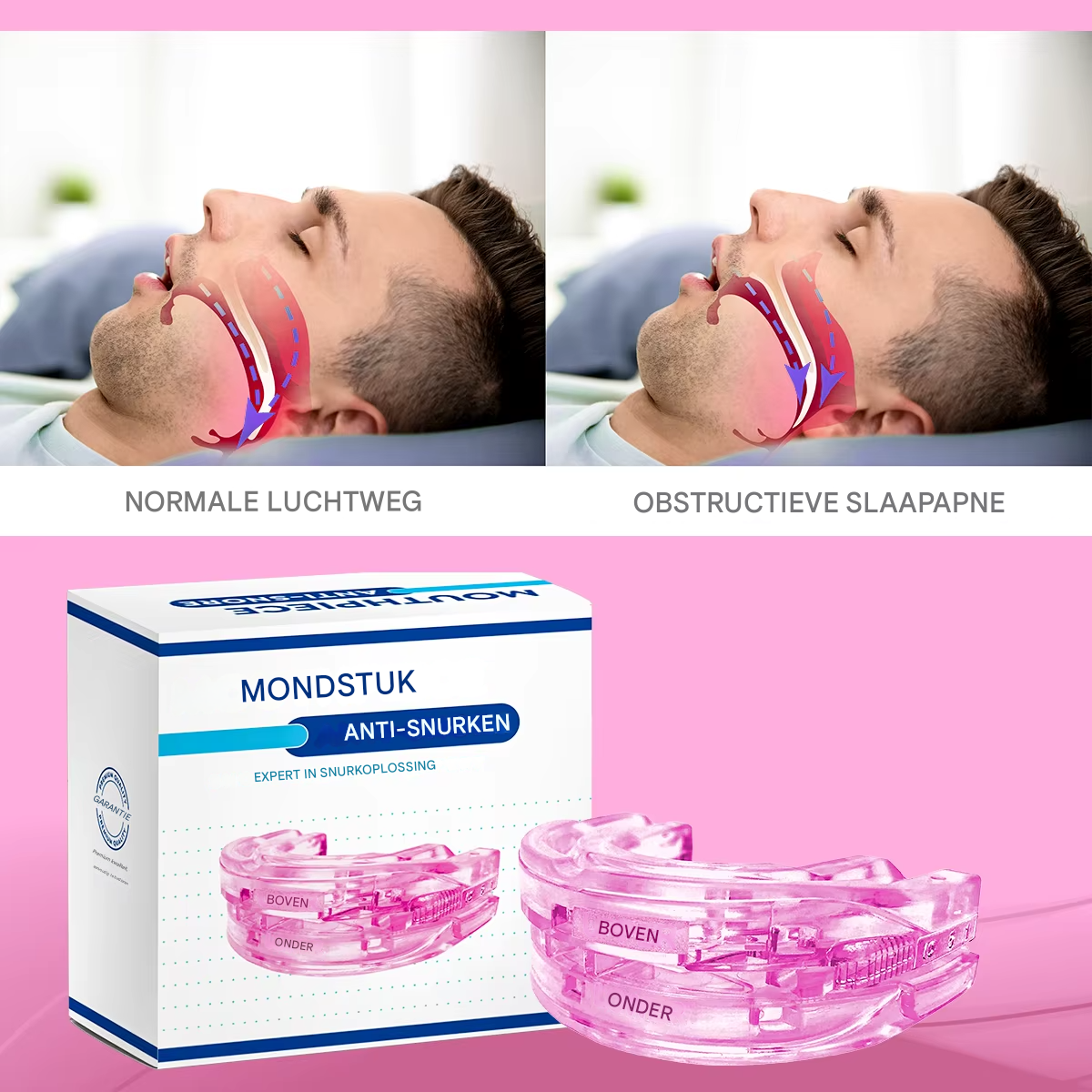 SomnoPro™ | The medical breakthrough that definitively stops sleep apnea and snoring