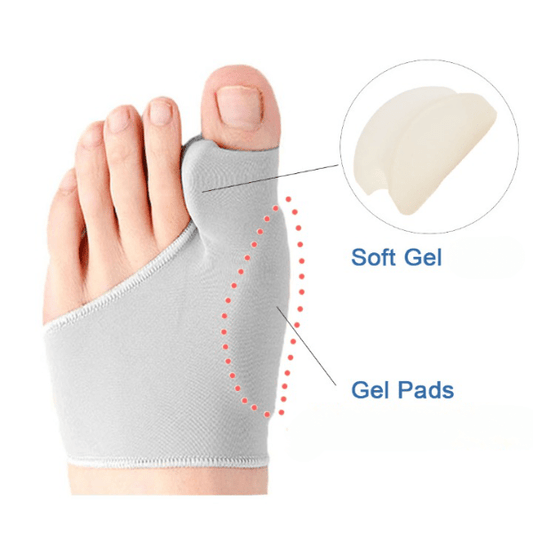 Teenager's Bunion Corrector, Discreet and Comfortable, Soft Skin-Colored Material – Pain Relief