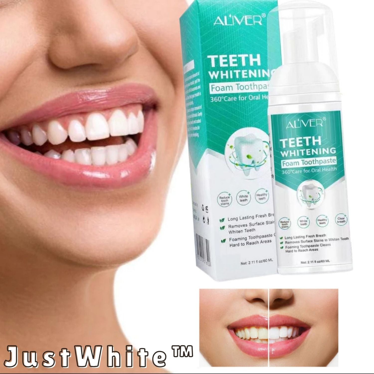 Teeth Whitening | Whitening Foam Toothpaste | Removes Stains | JustWhite