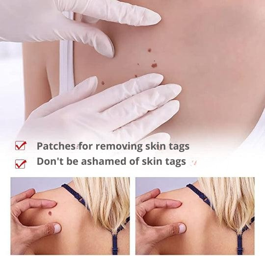 Wart Remover | Precision Applicator for Spot Treatment | Plant-Based Care Formula | WartOff